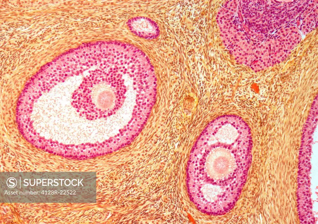 Ovarian follicles. Light micrograph of a section through secondary follicles in an ovary. Developing eggs oocytes are orange. They are surrounded by a...