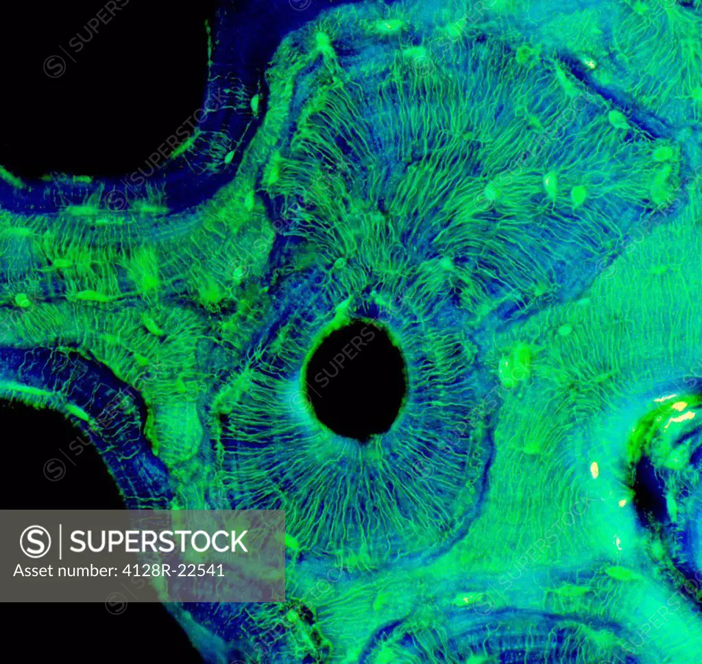 Compact bone, light micrograph. Compact bone consists of concentric layers of collagen_containing matrix lamellae, dark blue, around Haversian canals ...