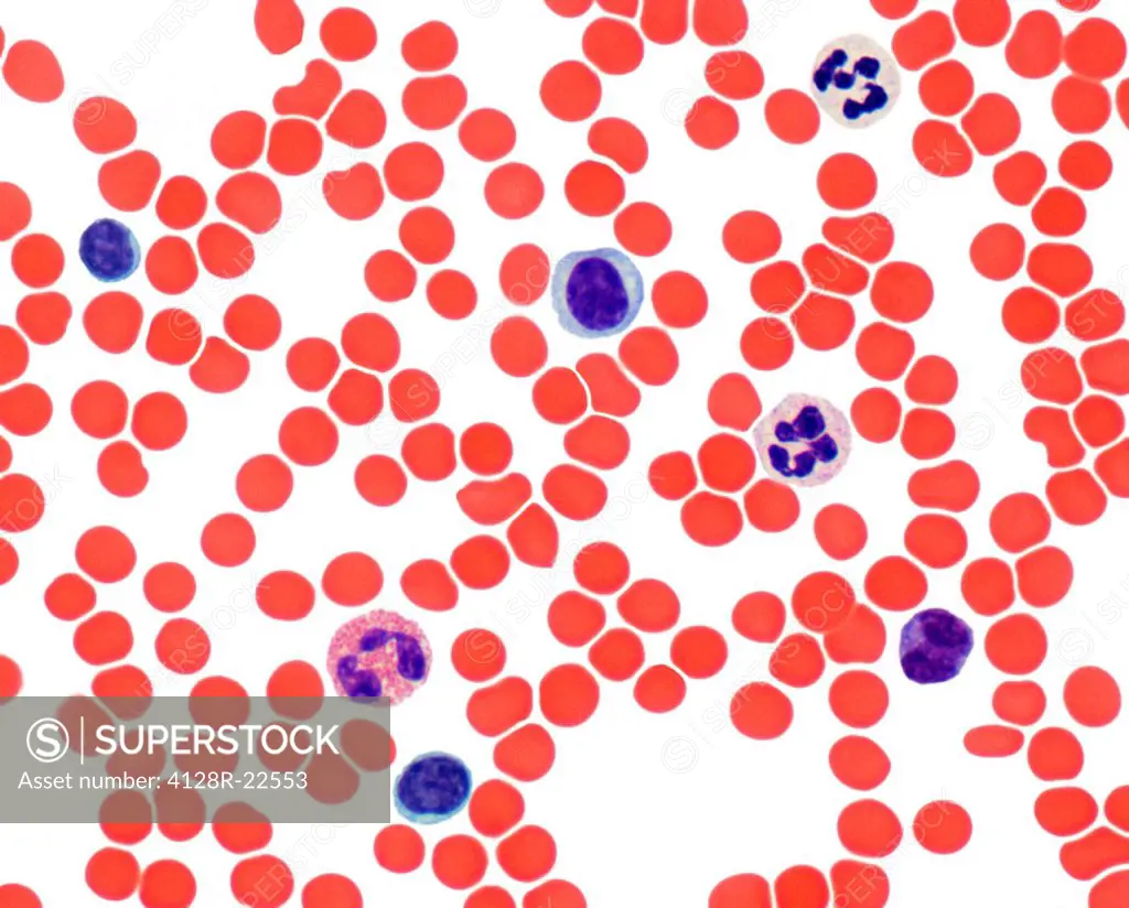 Blood smear. Light micrograph showing normal red and white blood cells. Magnification: x500 when printed at 10 centimetres wide.