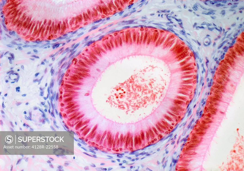 Epididymis. Light micrograph of a section through the epididymis showing pseudostratified columnar epithelium red, stereocilia light purple, hair_like...