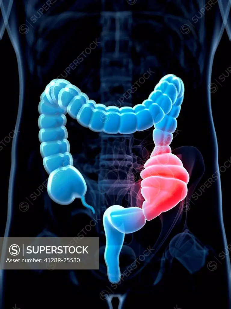 Constipated colon, computer artwork.