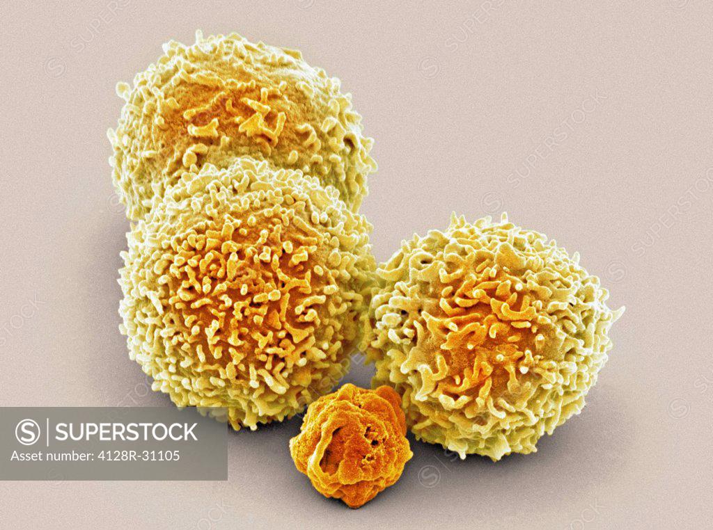 white-blood-cells-coloured-scanning-electron-micrograph-sem-of-white