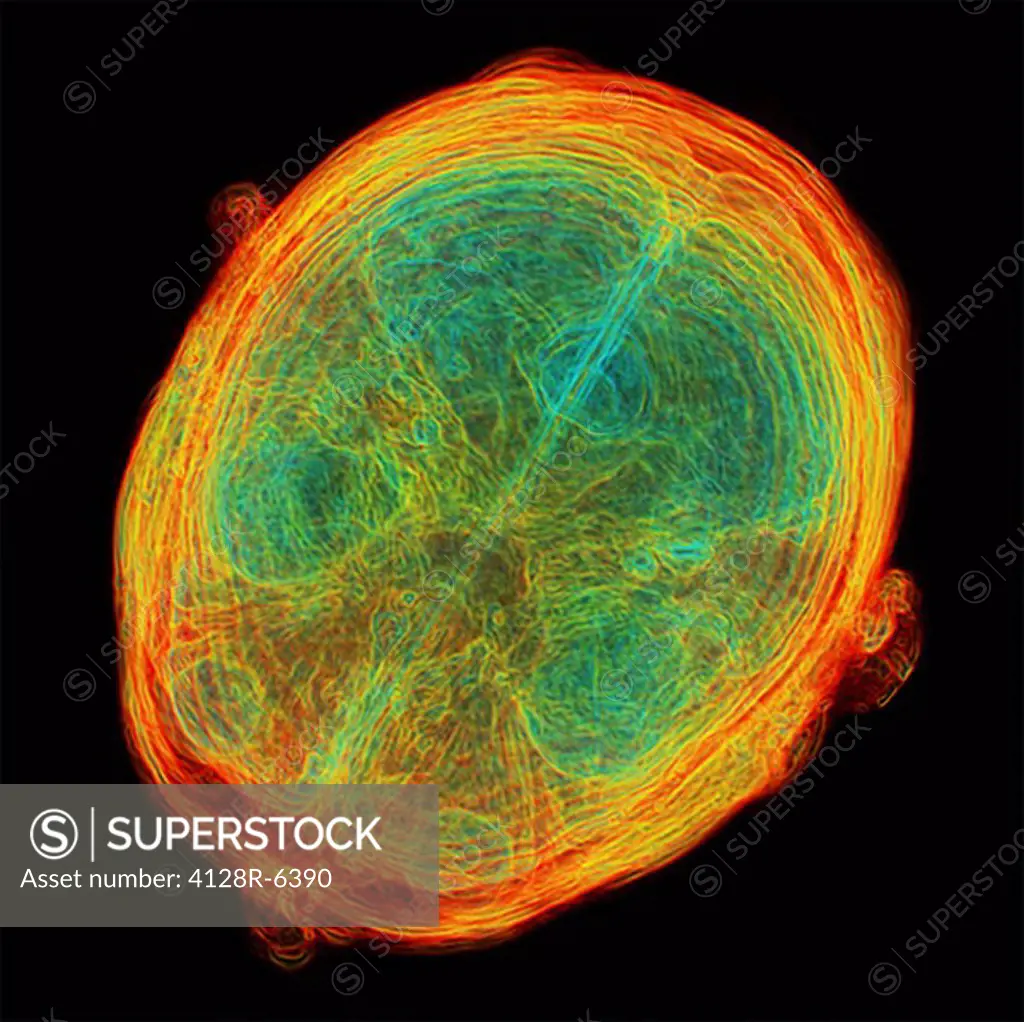 Brain scans. 3D_magnetic resonance imaging MRI scans of a healthy brain. Axial horizontal sections through the brain from the top of the brain towards...