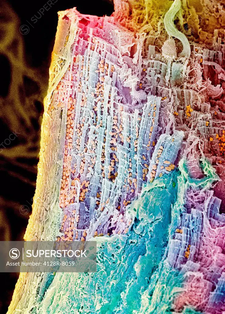 Cardiac muscle, SEM