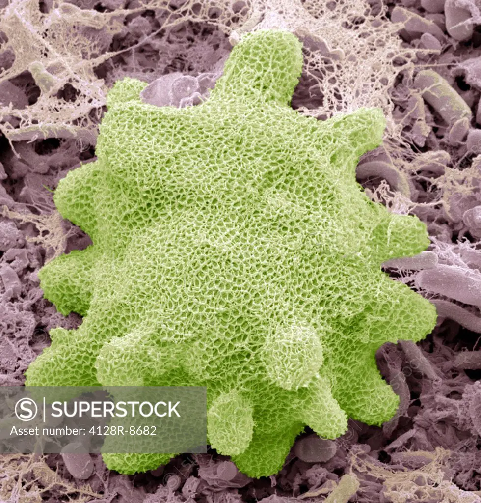 Korotnevella. Coloured scanning electron micrograph (SEM) of the scales covering a 'naked' amoeba of the genus Korotnevella. This is an amoeba with fi...