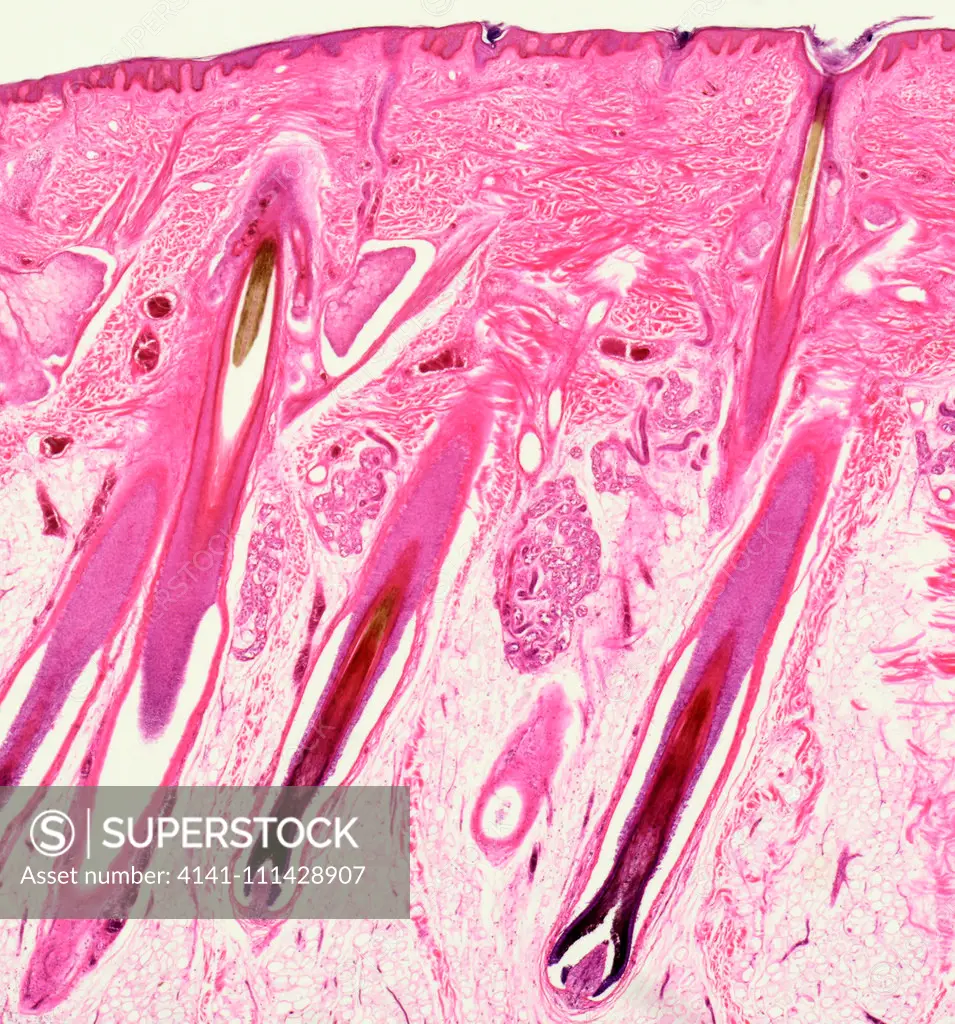 Light micrograph transverse section of a mammal skin section through the hair shaft and follicles. TS, UK