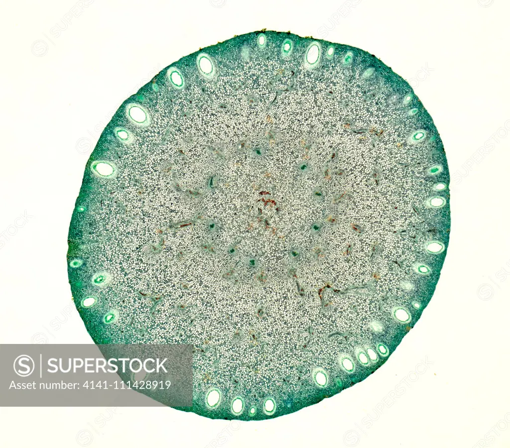 Light micrograph cross section through the young fruit of a Lemon tree (Citrus limon), UK.