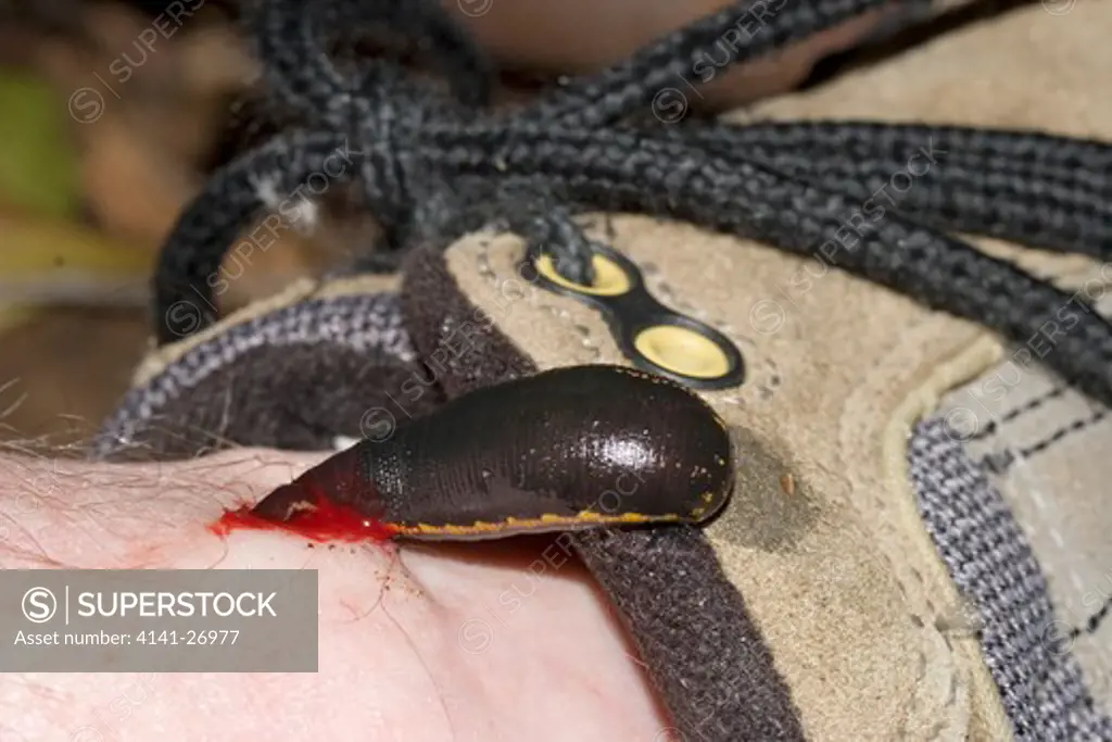 leech feeding on human leg australia