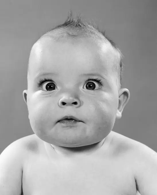 1950S Close-Up Of Baby With Bulging Eyes Staring Cross-Eyed Portrait Studio