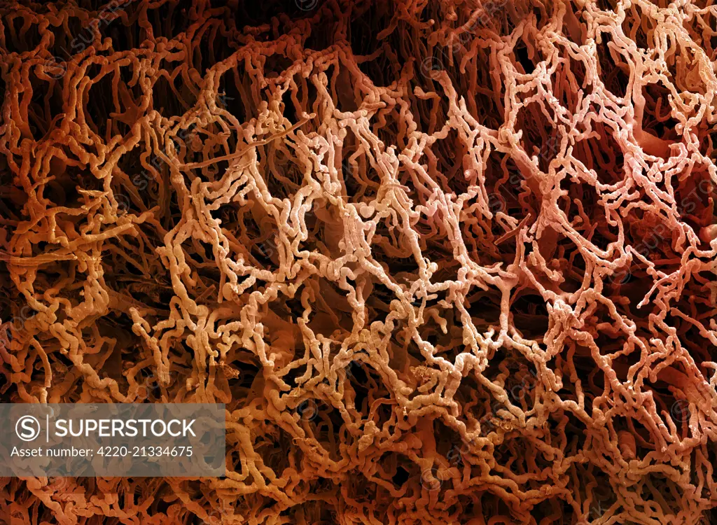 Scanning Electron Micrograph (SEM) of a resin cast of blood vessels in the intestines.     Date: 