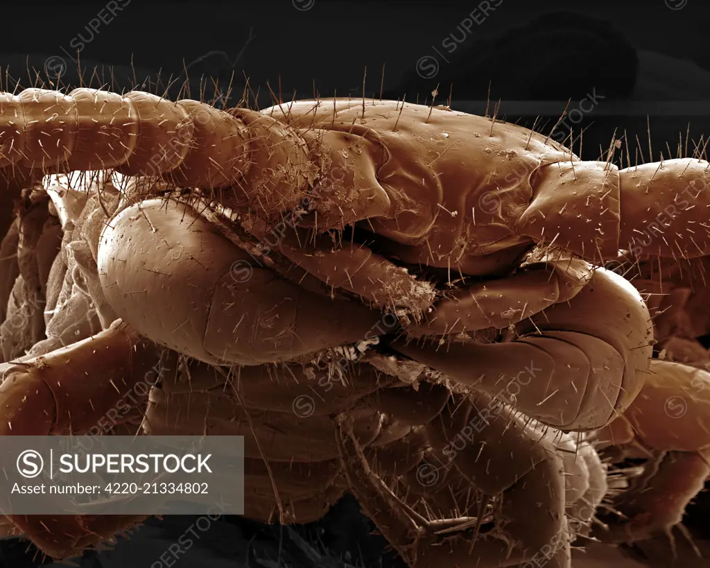 Scanning Electron Micrograph (SEM): Common Centipede.     Date: 