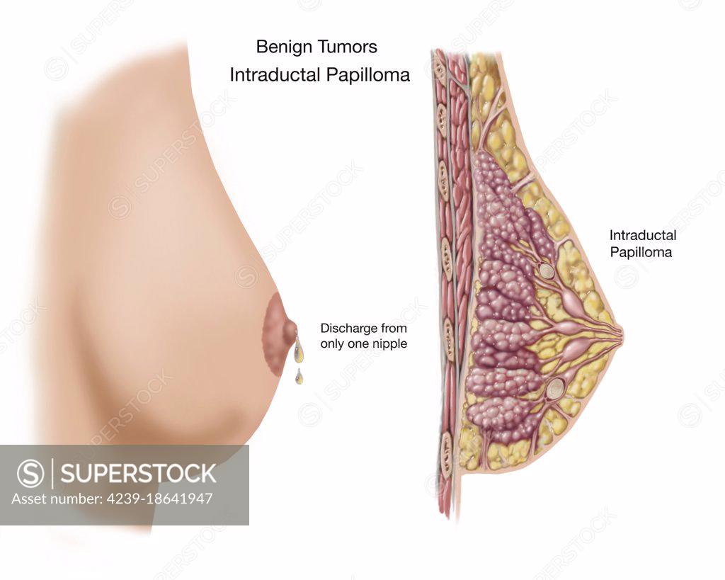 Anatomy of the Female Breast' Photographic Print - Stocktrek Images