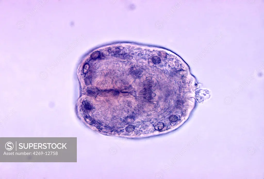 Hydatid (larvae) of the tenia Echinococcus granulosus. In its larval forma this parasite can cause hydatidosis, a development of hydatid cysts in the lungs, liver, rarely in the kidneys and bladder. Light micrograph. CDC/ Dr. L.L.A. Moore, Jr.