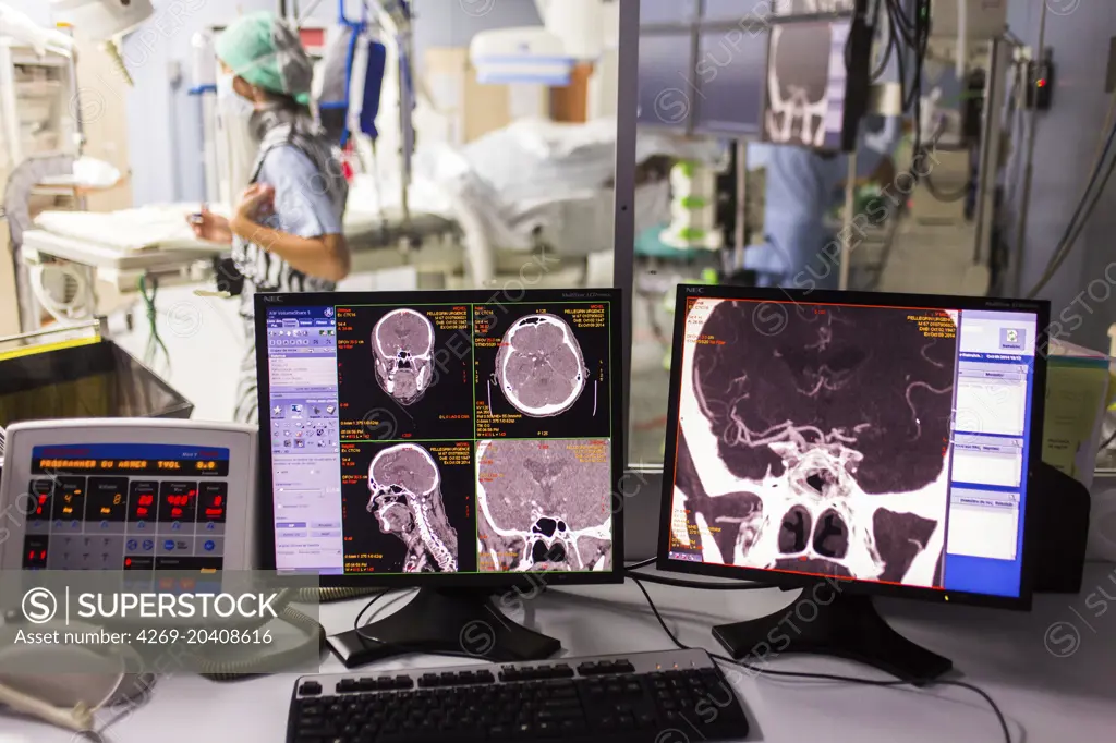 Thrombectomy performed under cerebral angiography on a patient with symptoms of a stroke, Neuro-Vascular Unit (UNV) CHU Bordeaux.