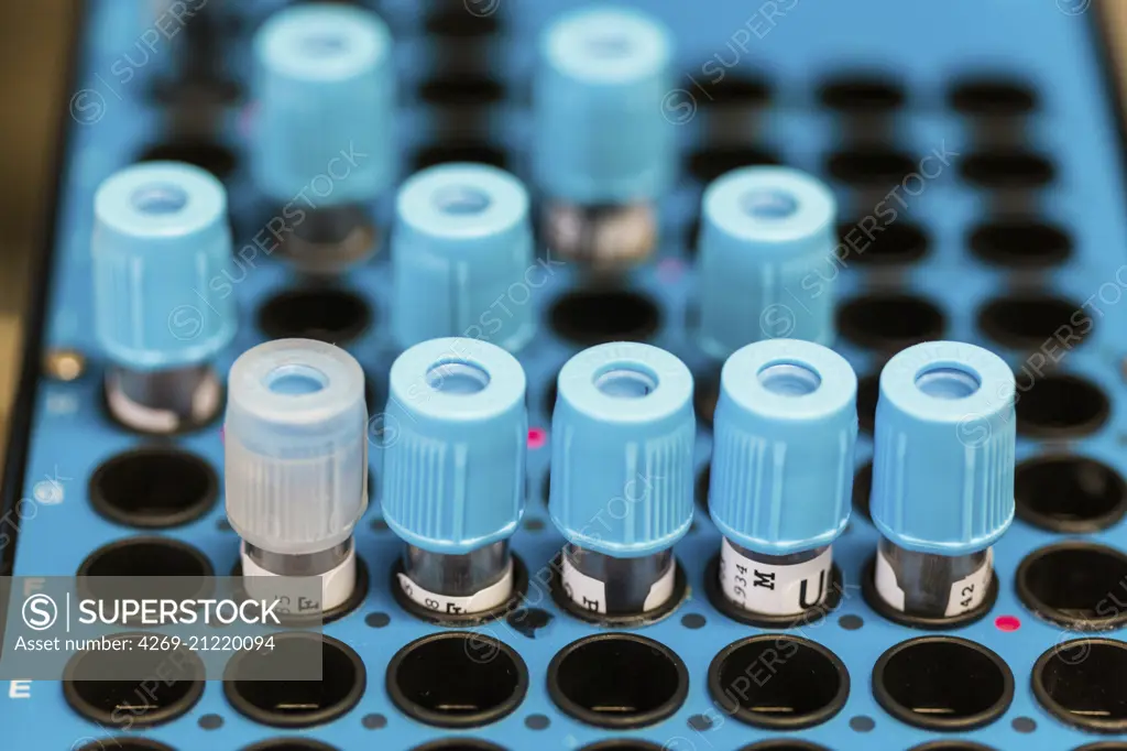 Laboratory Hematology, Automaton analysis blood samples.