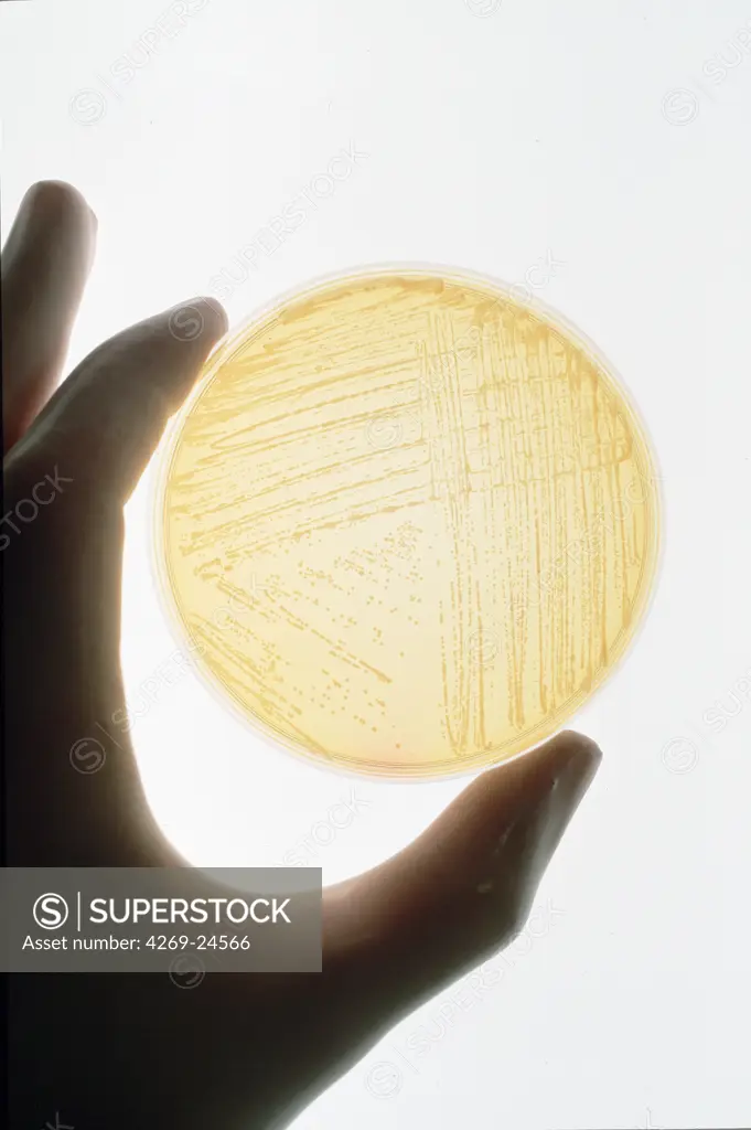 Bacteriology. Culture of Gram-positive Staphylococcus aureus in Petri dish .