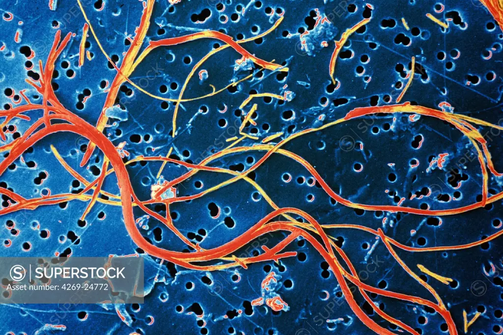 Asbestos. Asbestos fibres, responsible for lungs affections such as asbestosis ESM (Electron Scanning Microscope) (x3000)