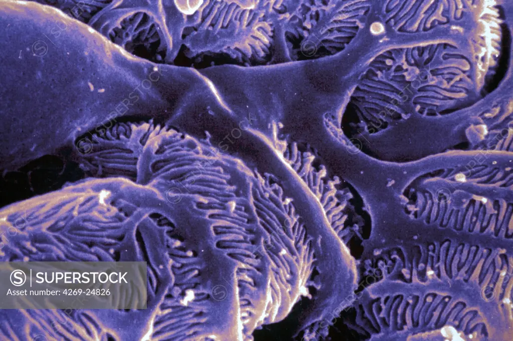 kidney glomerulus. Coloured Scanning Electron Micrograph (SEM) of podocyte cells on a glomerulus in the kidney. Glomeruli are tight knot of blood capillaries covered with podocyte cells, which function is to filter the blood and produce primary urine.