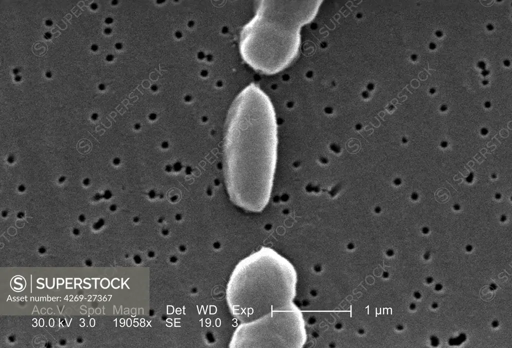 Vibrio parahaemolyticus. Scanning electron micrograph (SEM) of Vibrio parahaemolyticus. bacteria. This Gram-negative bacterium causes gastointestinal infection to man. It is closely related to Vibrio cholerae, the  agent of cholera. Magnified 19058x.