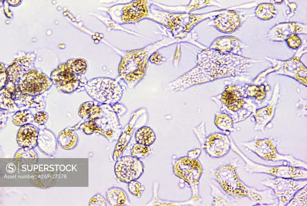 Trypanosoma cruzi. Photomicrograph of Trypanosoma cruzi, the parasite protozoan that causes Chagas' disease (American trypanosomiasis).