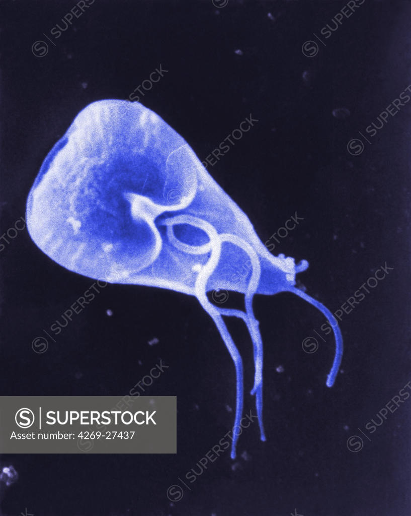 Giardia Lamblia Scanning Electron Micrograph Sem Of Giardia Lamblia This One Celled 3121