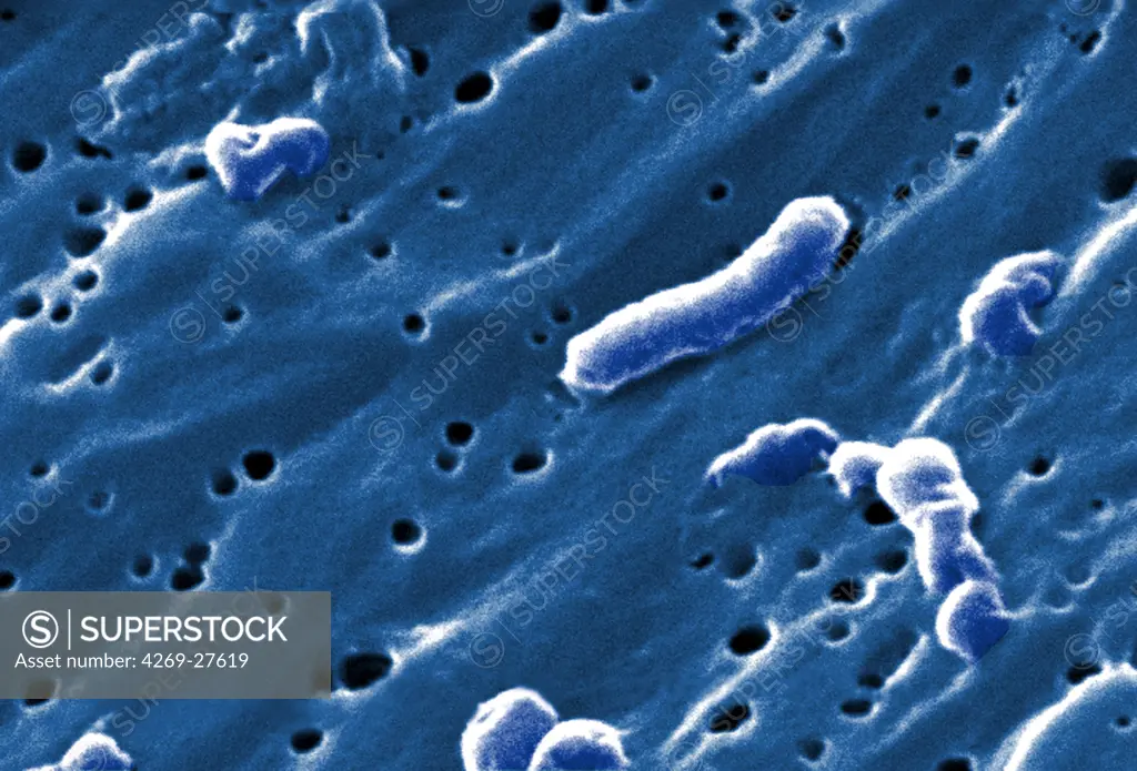 Vibrio cholerae. Scanning electron micrograph (SEM) of Vibrio cholerae bacteria. This Gram-negative bacterium causes cholera. Magnified 22371x.