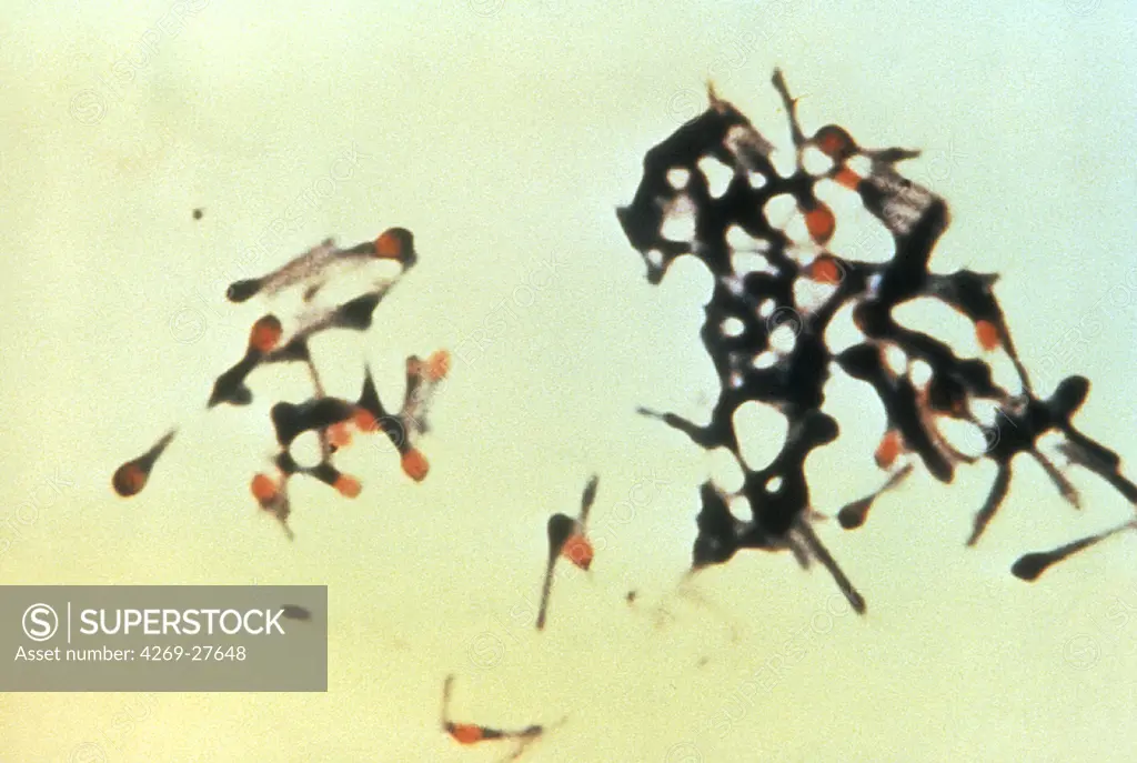 Clostridium tetani. Micrograph of Clostridium tetani, a Gram-positive bacteria responsible for causing tetanus.