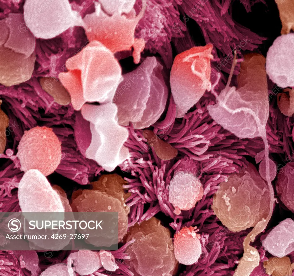 Bronchiolar cells. Scanning electron micrograph (SEM) of red blood cells on the surface of bronchiolar epithelium.