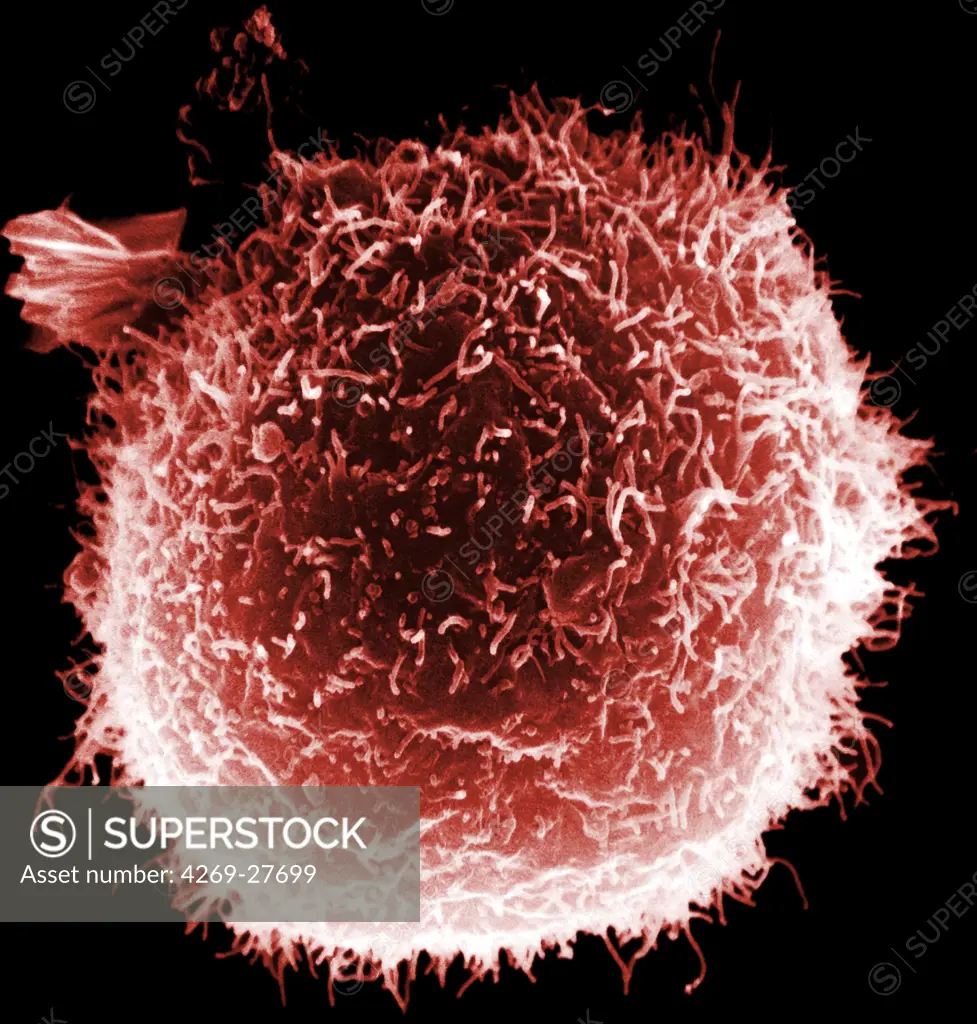 Macrophage. Scanning electron micrograph (SEM) of a macrophage.