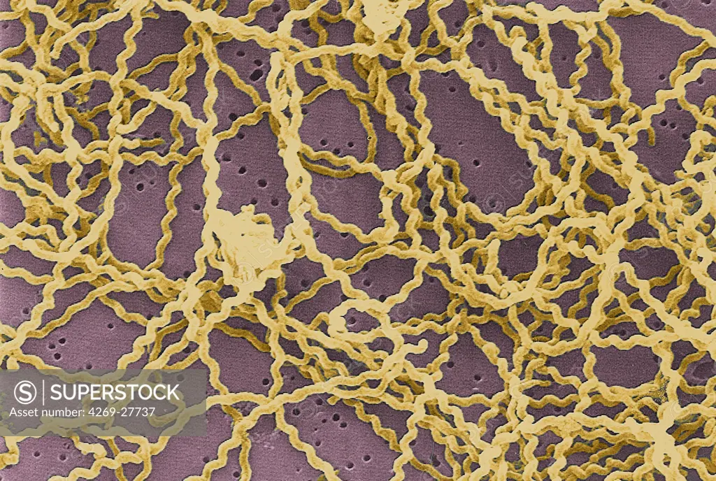 Leptospira. Scanning electron micrograph (SEM) of the Gram-negative bacteria Leptospira sp. Leptospira is a type of spirochete. Many species are pathogenic, causing leptospirosis (Weil's disease) or other diseases with similar symptoms, attacking the liver (jaundice) or the meninges of the brain (meningitis).