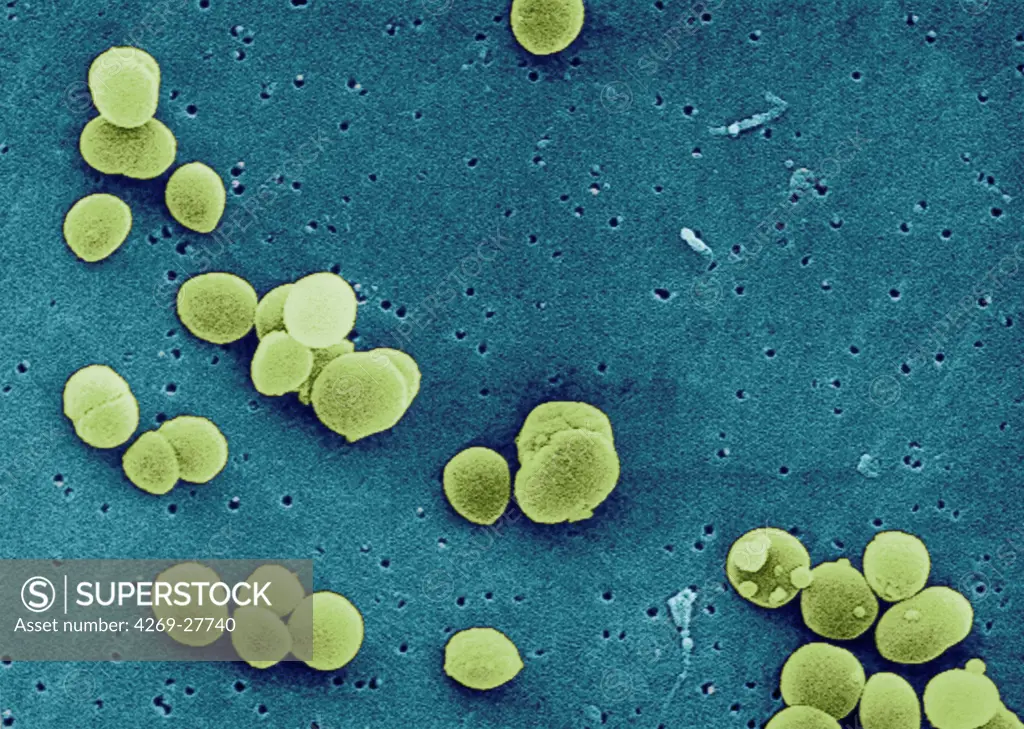 Staphylococcus aureus. Color ehanced scanning electron micrograph (SEM ...