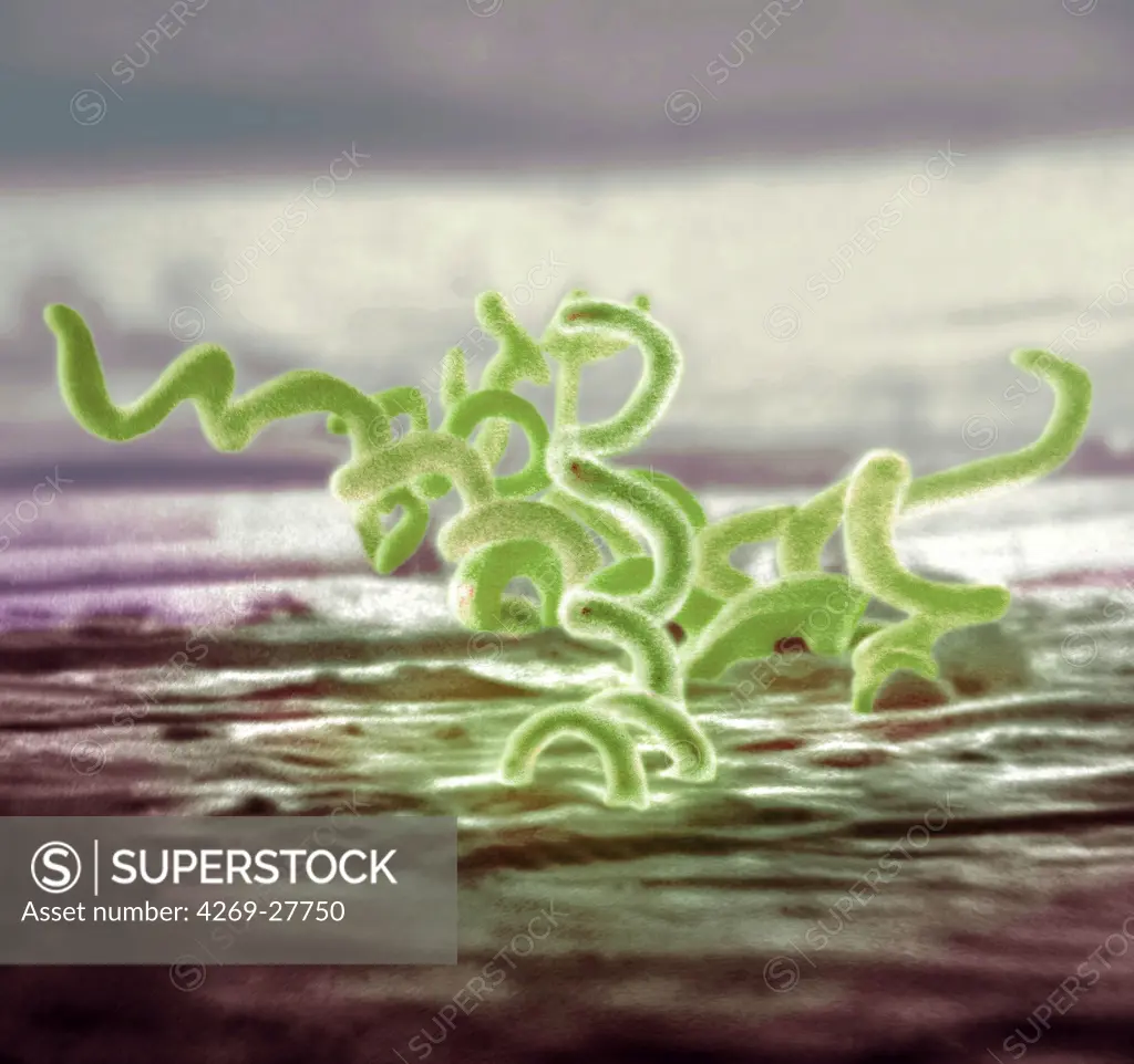 Treponema pallidum. Scanning Electron Micrograph (SEM) of Treponema pallidum. This spirochete bacterium is the agent of syphilis.