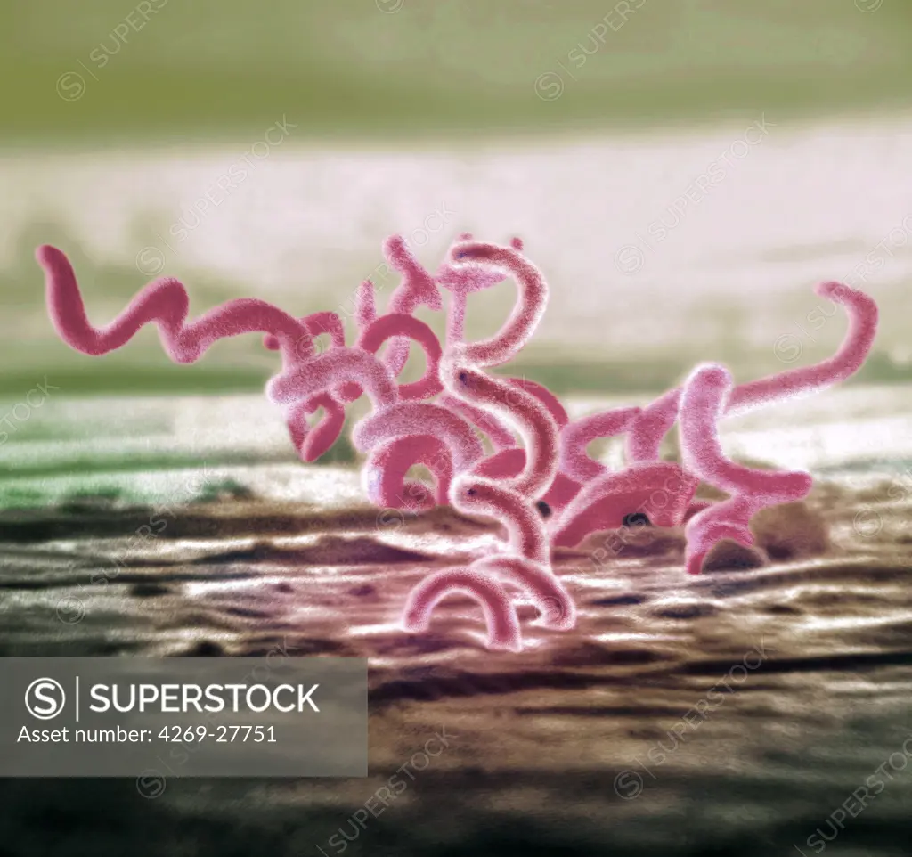 Treponema pallidum. Scanning Electron Micrograph (SEM) of Treponema pallidum. This spirochete bacterium is the agent of syphilis.