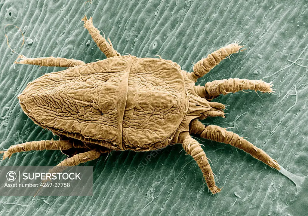 Flat mite. The flat mite (Brevipalpus phoenicis) carries the leprosis virus, which affects citrus fruits. The disease is currently in South America but moving north. Magnified about 150x.