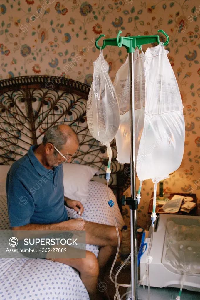 Peritoneal dialysis. Patient undergoing automated peritoneal dialysis at home : connexion of the dialysate bags to the catheter.