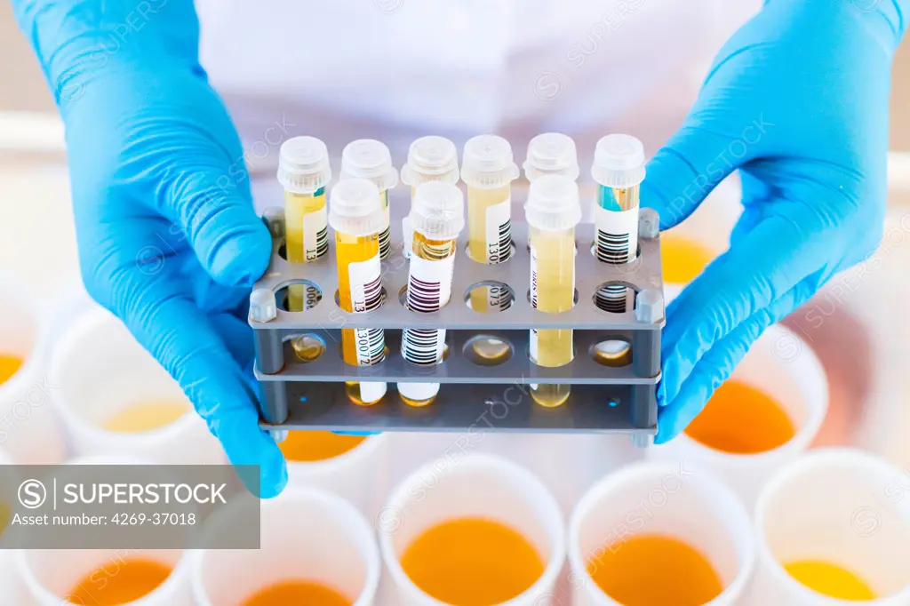 Laboratory, Urine analysis in laboratory.