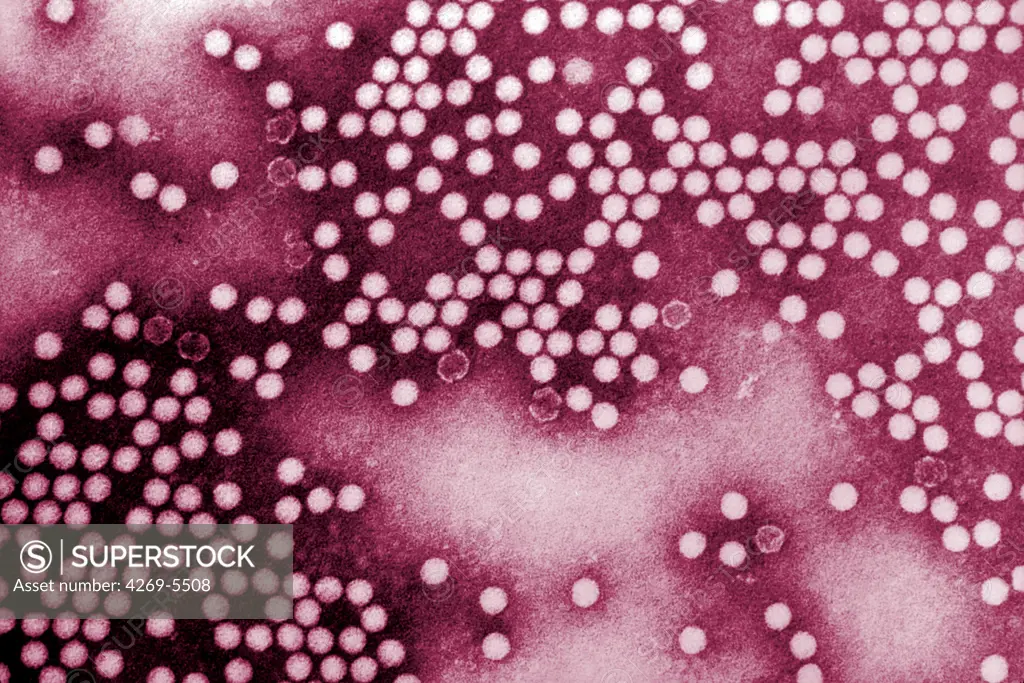 Transmission Electron Micrograph (TEM) of poliovirus, an RNA enterovirus responsable for poliomyelitis.