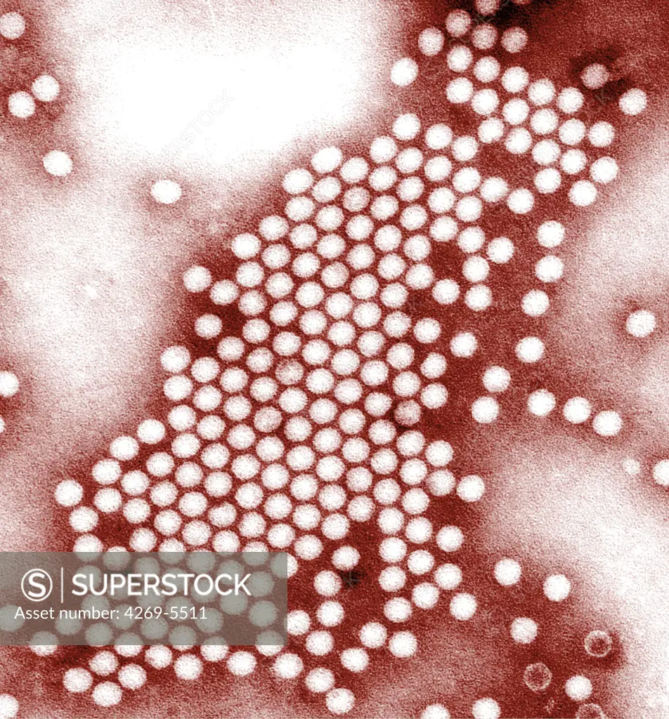 Transmission Electron Micrograph (TEM) of poliovirus, an RNA enterovirus responsable for poliomyelitis.