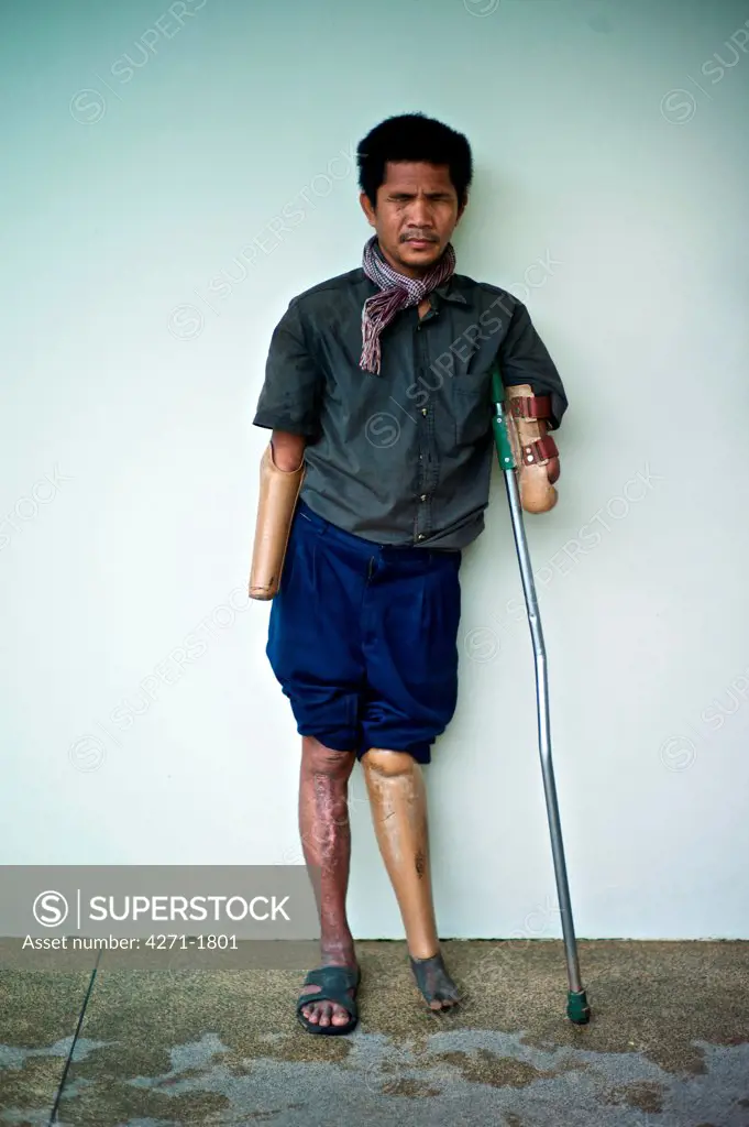 Portrait of a Cambodian land mine survivor lost both eyes and a leg and both arms now using a prosthetic rudimentary wooden limbs, Luang Phabang, Laos