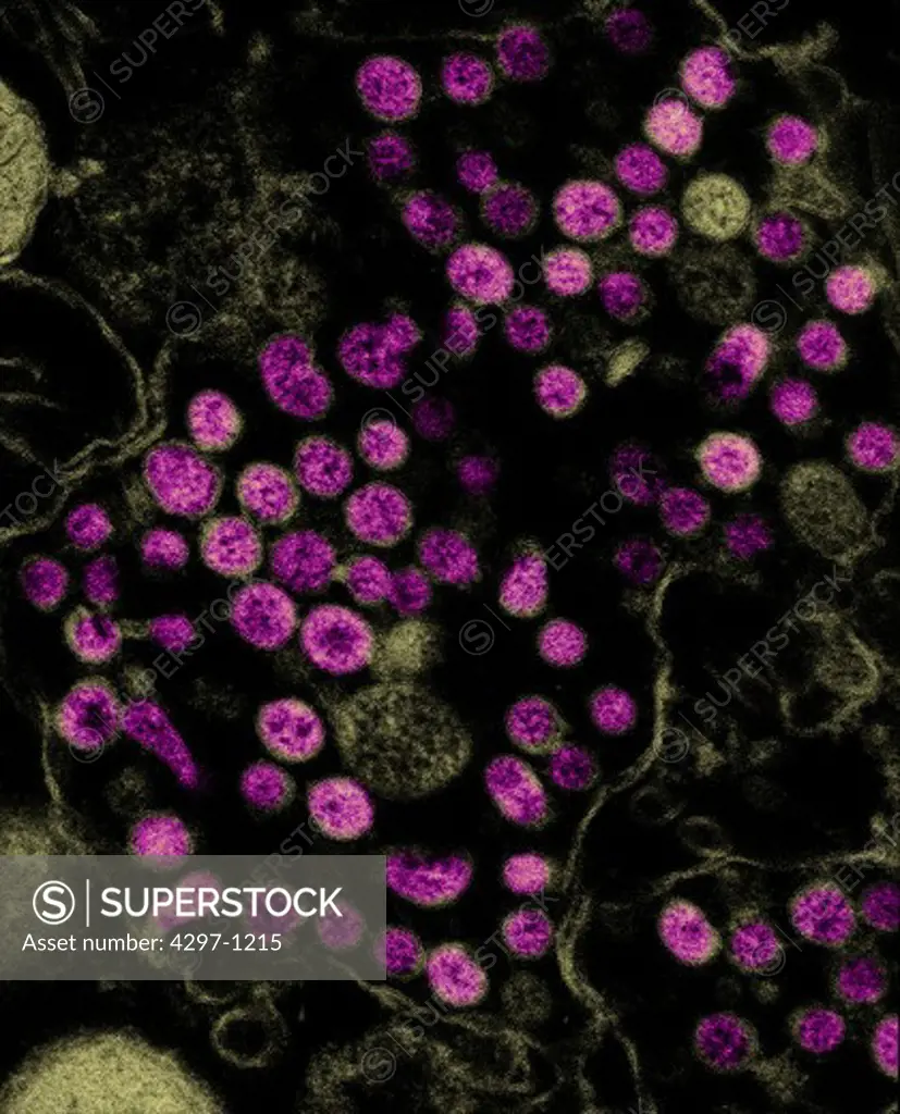 TEM image of coronavirus, the causative agent of SARS