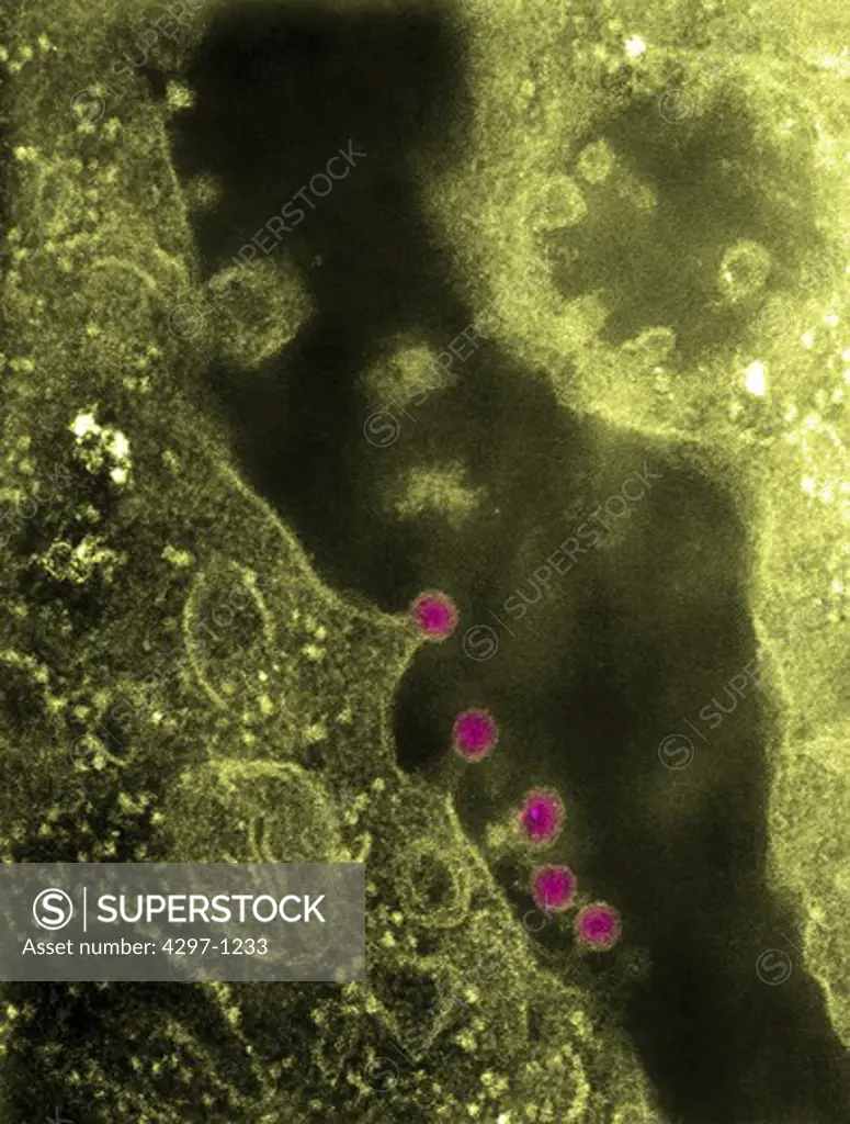 Negatively-stained TEM image of Rubella virus virions