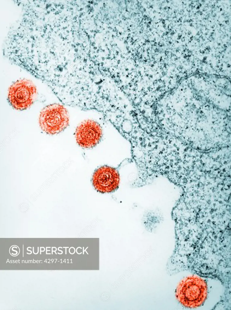 colorized electron micrograph image of HHV-6, or the human herpes virus-6, was thought to infect b-cells and was at one time called HBLV, human b-lymphotropic virus