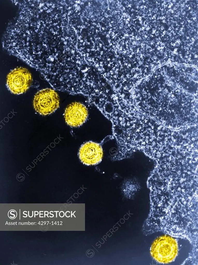 colorized electron micrograph image of HHV-6, or the human herpes virus-6, was thought to infect b-cells and was at one time called HBLV, human b-lymphotropic virus