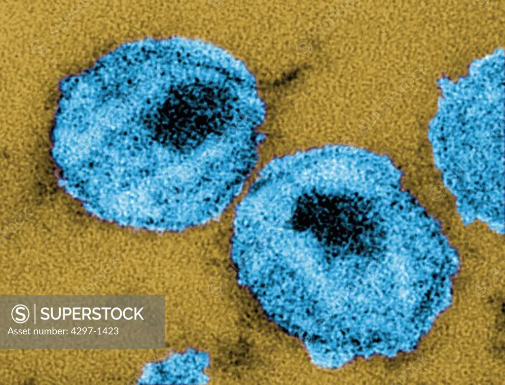 Thin-section transmission electron micrograph showing the ultrastructural details of two human immunodeficiency virus (HIV) particles