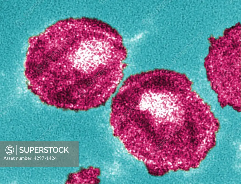 Thin-section transmission electron micrograph showing the ultrastructural details of two human immunodeficiency virus (HIV) particles