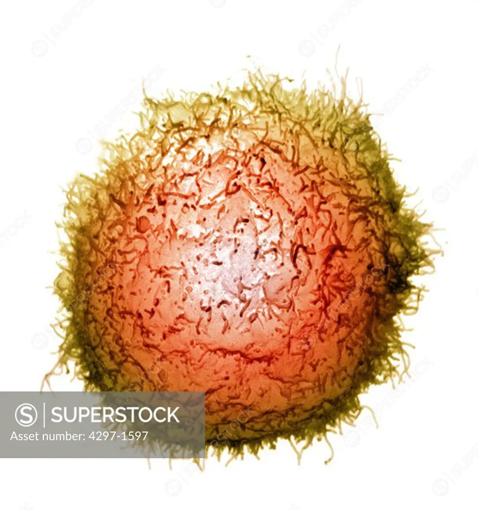 Scanning electron micrograph of a single macrophage with projectile-looking surface