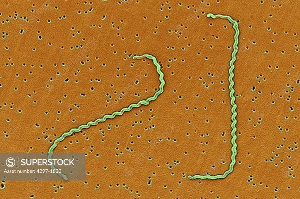 Scanning electron micrograph of Leptospira interrogans strain RGA showing two spirochetes bound to a 0.2 µm filter