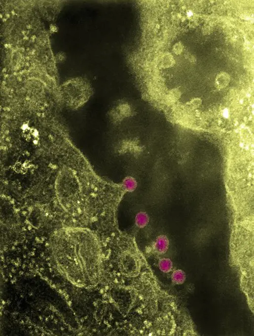 Negatively-stained TEM image of Rubella virus virions