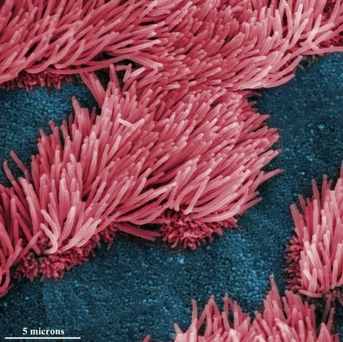 Scanning electron microscopic image of lung trachea epithelium