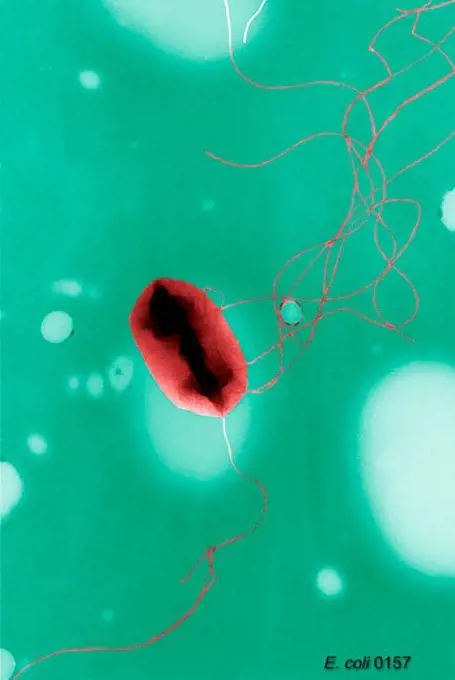 Colorized scanning electron micrograph of a single Gram-negative Escherichia coli bacterium